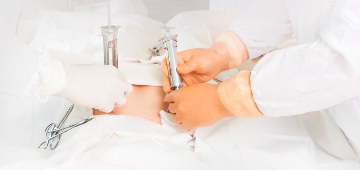 bone marrow transplant